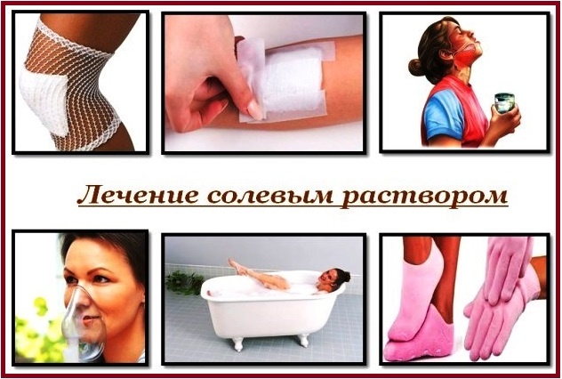 Наружное применение солевого раствора