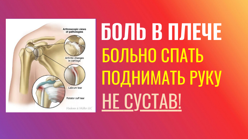 ЛФК при боли в плече с внешней стороны. Больно спать на боку, поднимать руку. Причины боли, готовые упражнения.