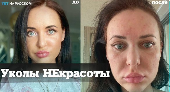 Иллюстрация взята из анонса в СМИ по данному делу