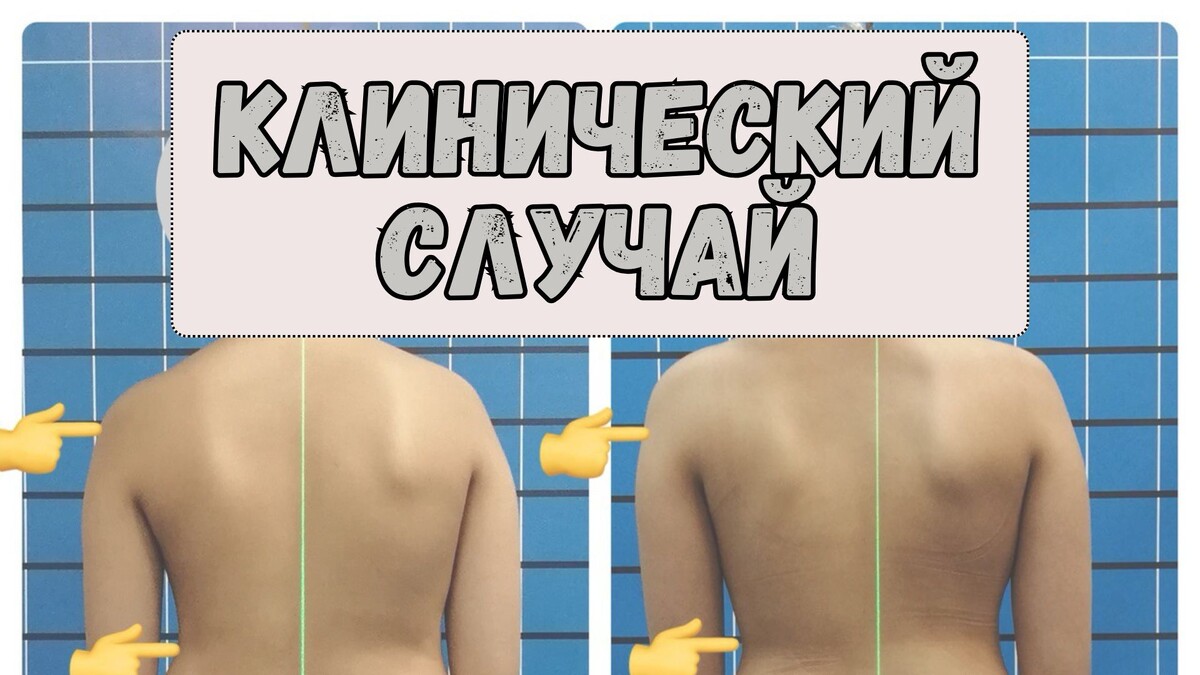 Клинический случай