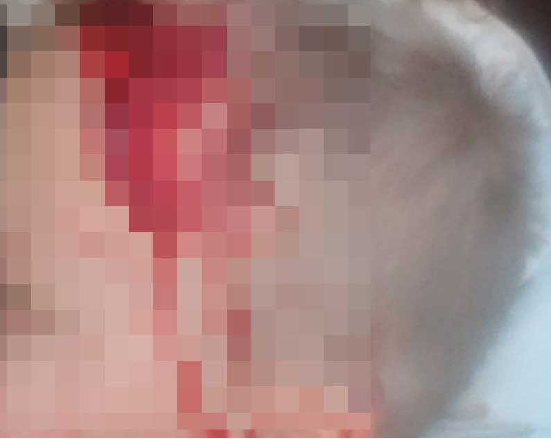 Травмированный велодоставщиком ребёнок. Фото из соцсетей. 