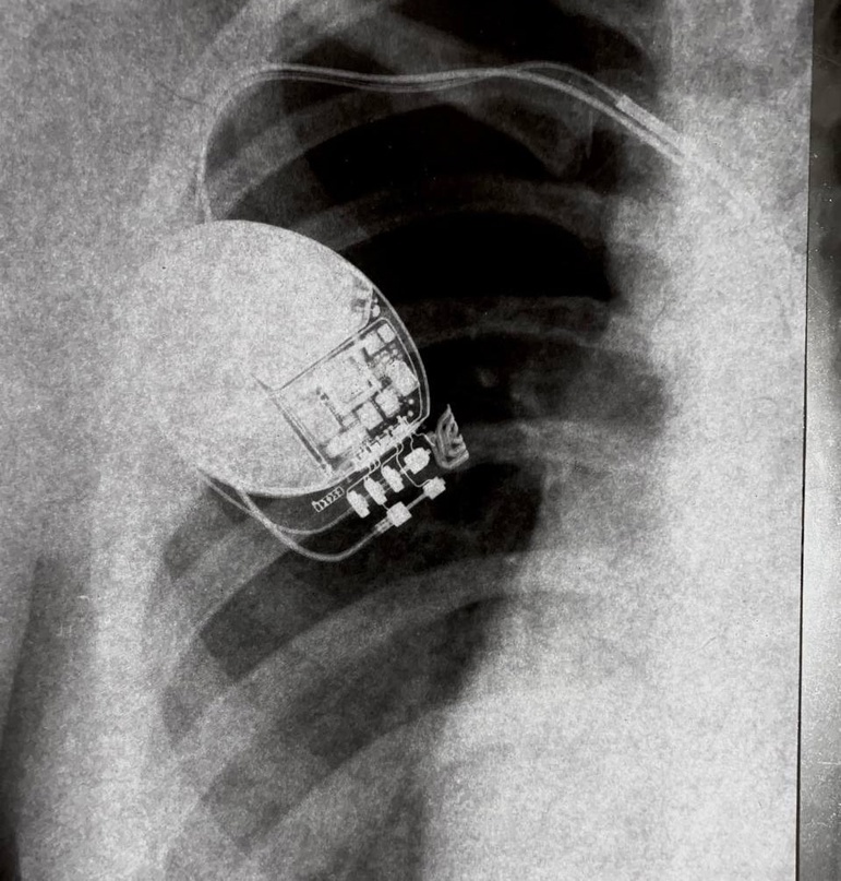 «Фото моего прибора»