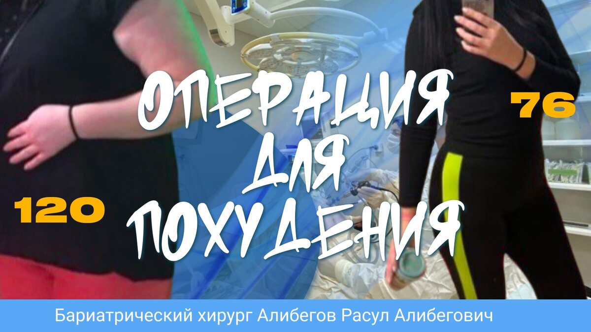 Операция для похудения на желудке