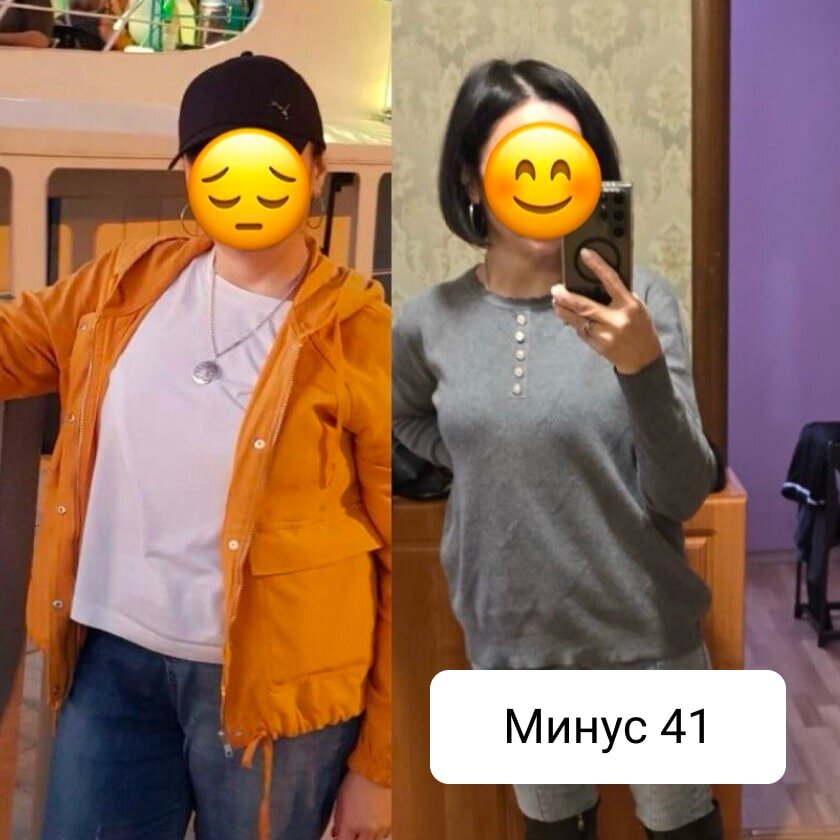 Пациентка после бариатрической операции