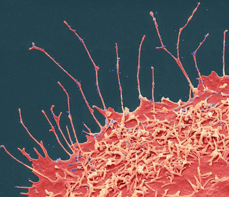 РНК-вирусы, включая SARS-CoV-2, постоянно накапливают новые мутации. Фото: Steve Gschmeissner/SPL