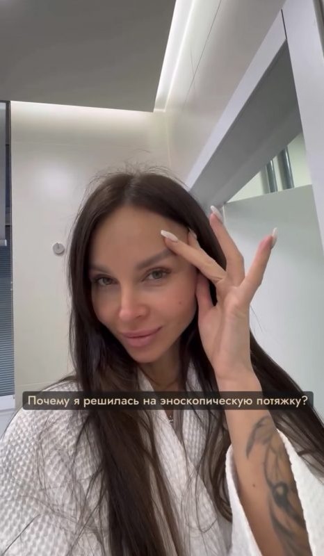     До пластики
📷    После
