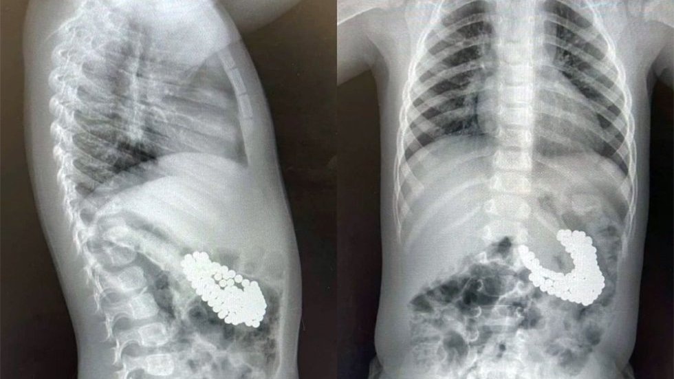    Фото: минздрав Московской области