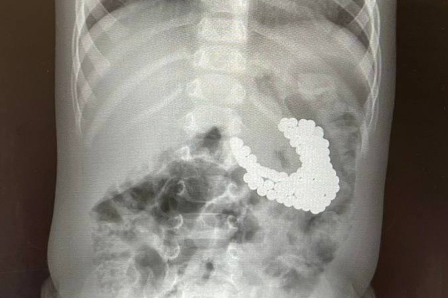    пресс-служба Минздрава МО