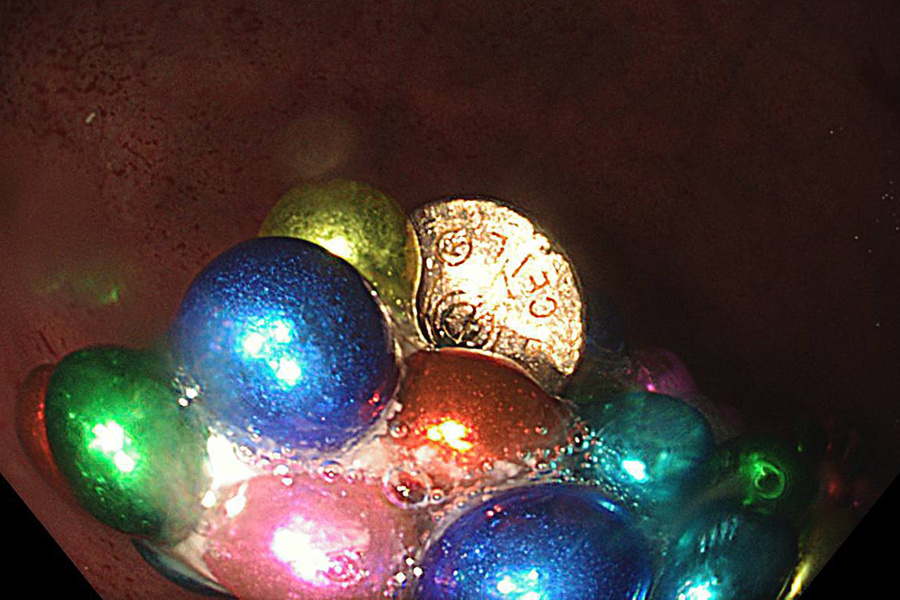    пресс-служба Минздрава МО