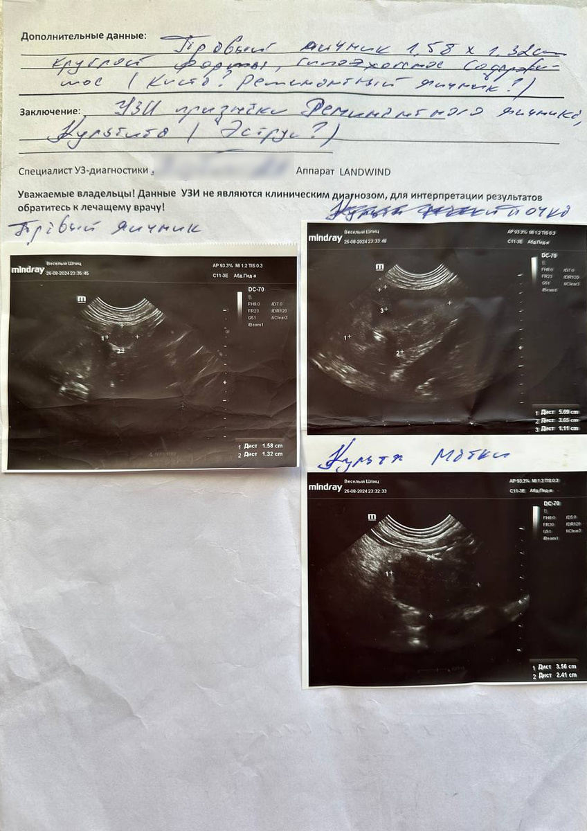Первое УЗИ, которое показало, что оставлен правый яичник. 