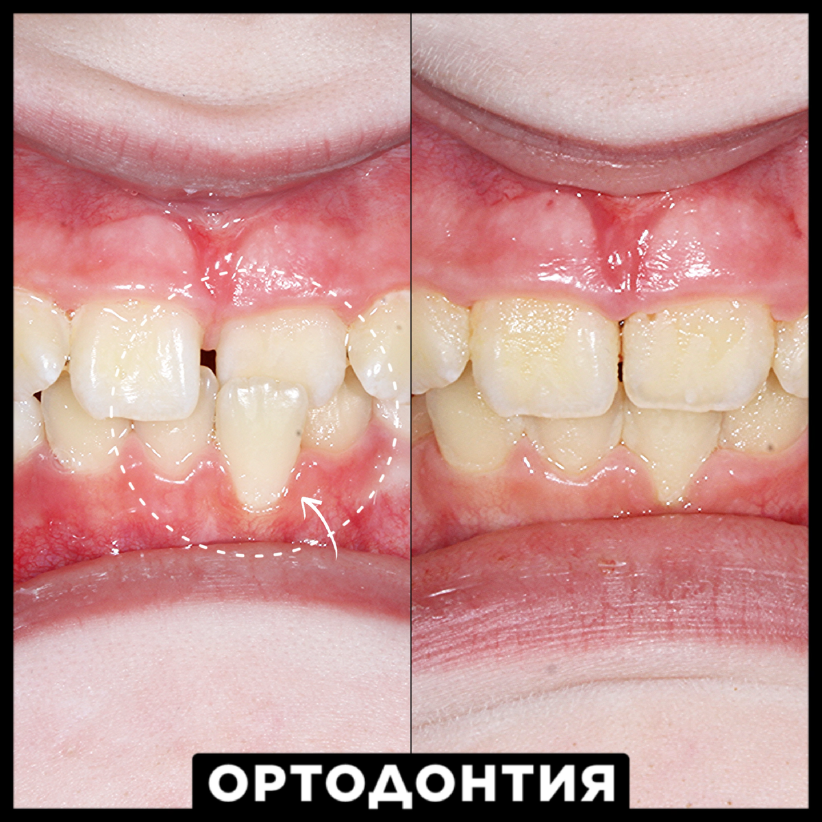 Детская ортодонтия в Сочи