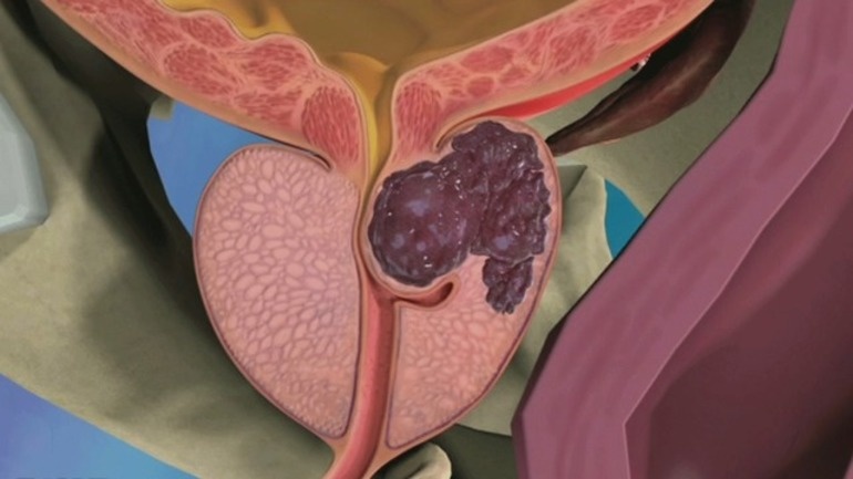 Фото: Яндекс Картинки 