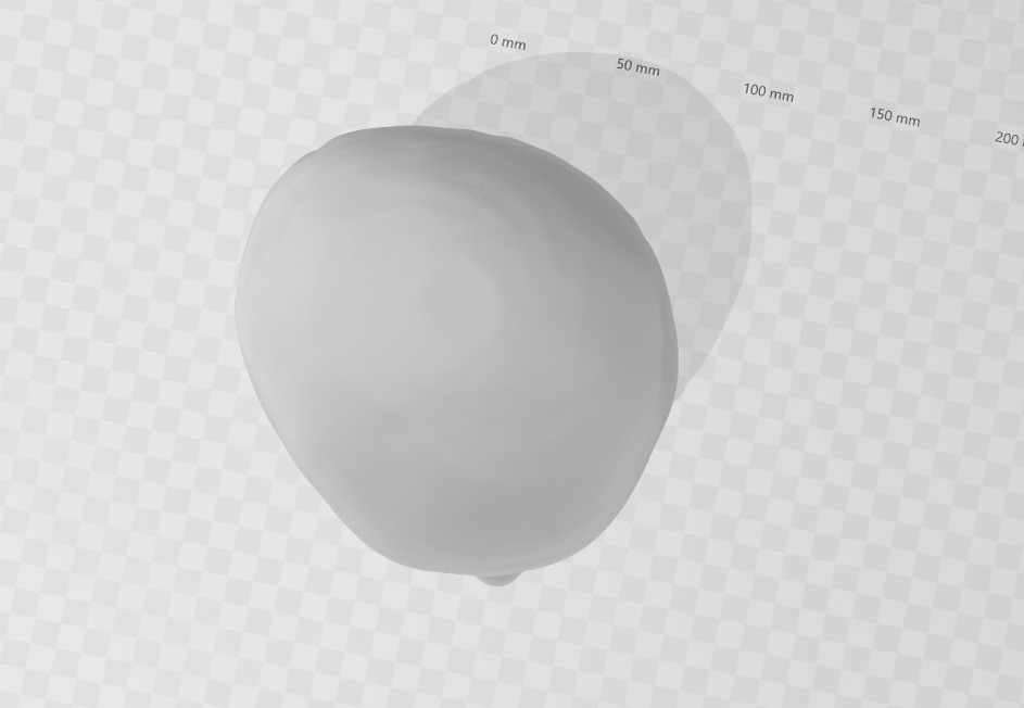 Результат сканирования головы ребенка