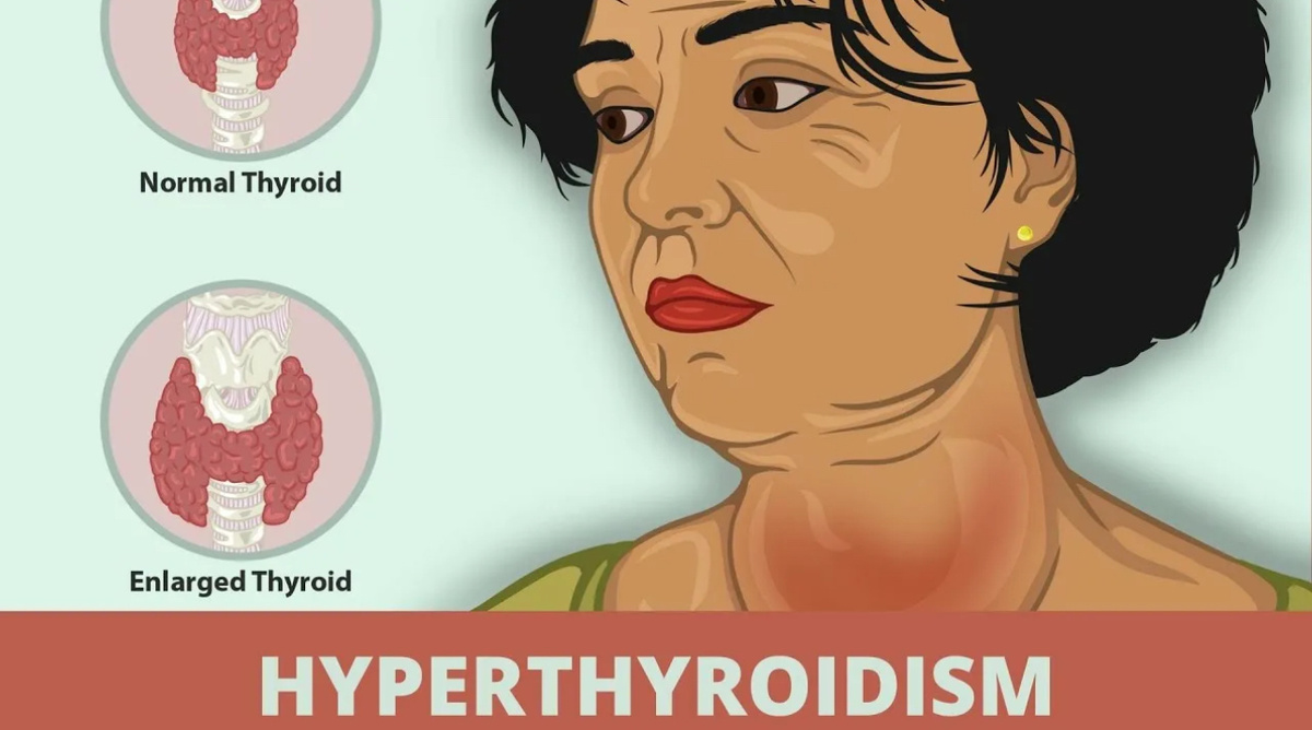 Сравнение размеров нормальной и увеличенной железы