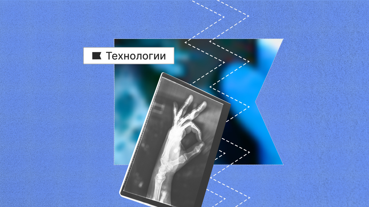 Установка визуализирует неоднородности в объектах в сотни раз тоньше человеческого волоса.