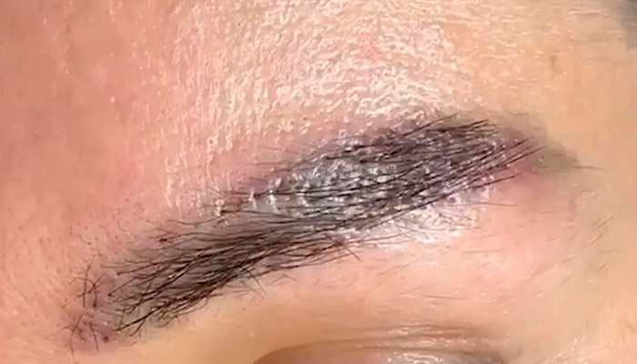 Так выглядит реконструированная методом BrowFlash бровь. Фото: кадр из видео