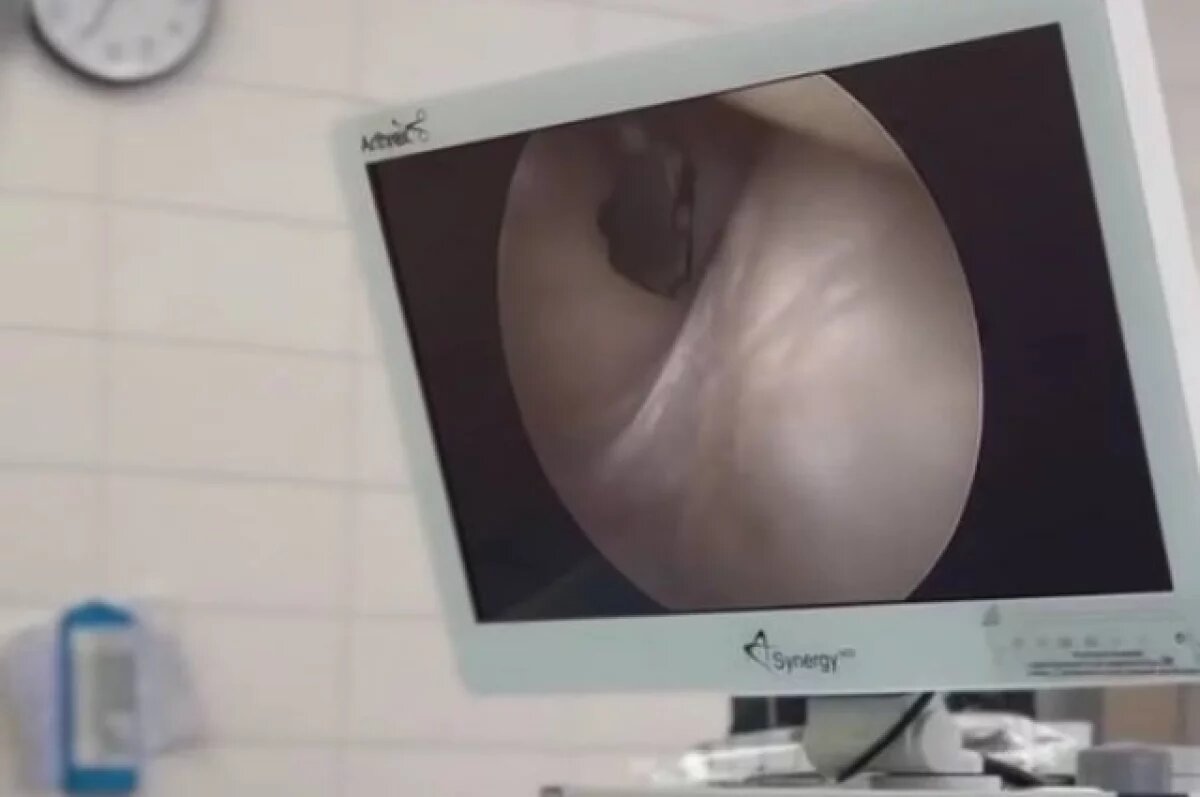    Осколок снаряда извлекли из колена бойца СВО врачи Удмуртии