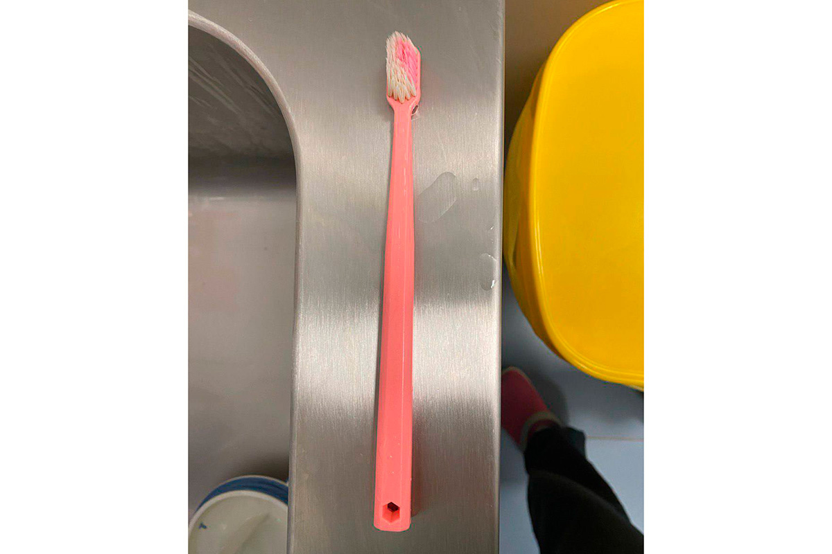 Пресс-служба Минзрава Московской области📷Зубная щетка, извлеченная из желудка 16-летней девушки