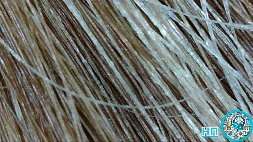 Седые волосы в увеличении.