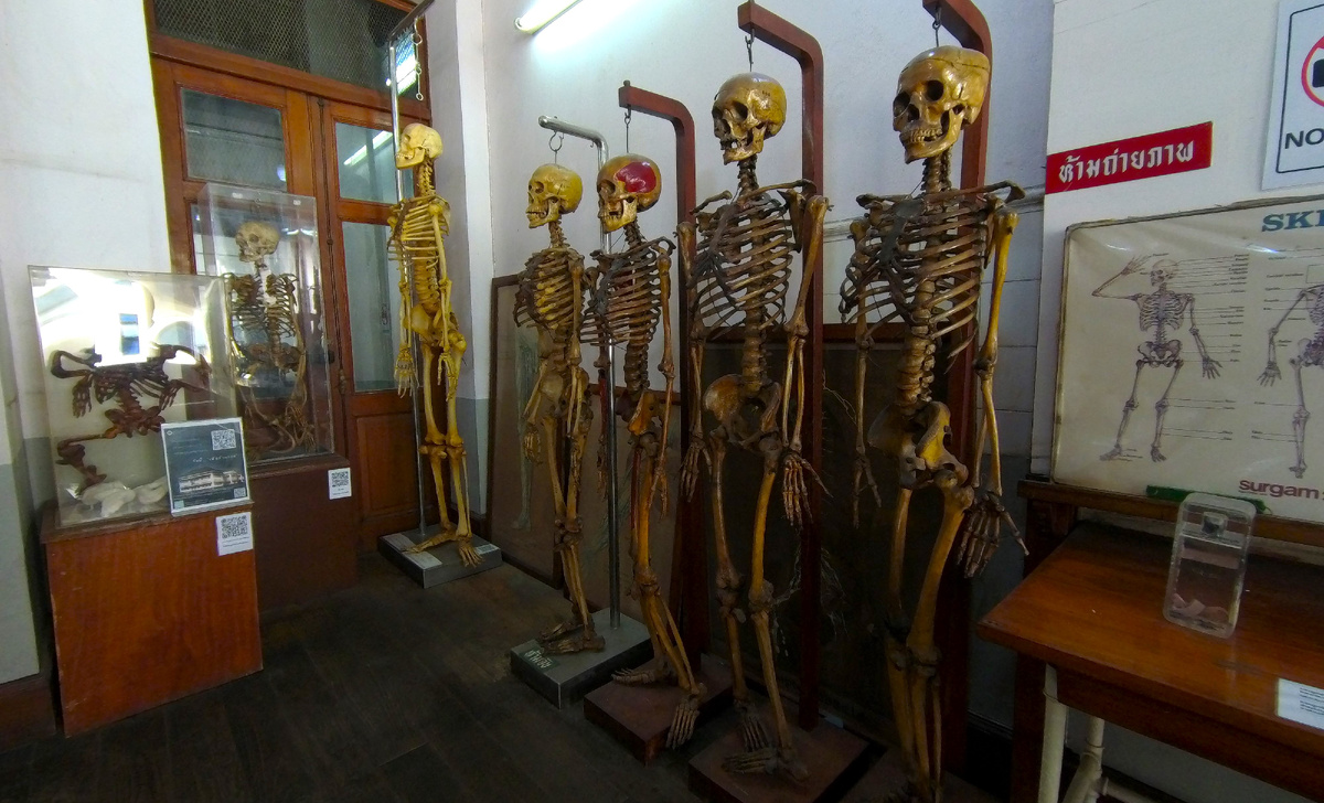 Скелеты в одном из залов анатомического отдела музея. Фото автора.
