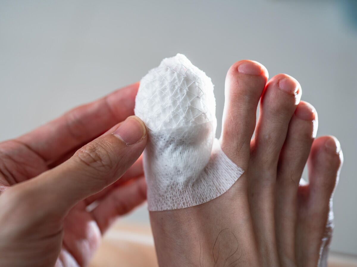    Перелом большого пальца ноги © iStock.com / Wachiwit