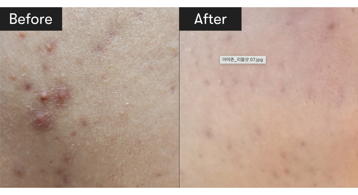 Такое до/после приводит бренд VT Cosmetics