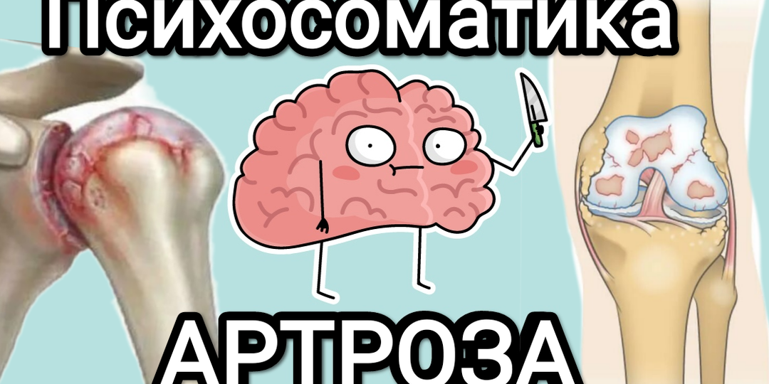 Психосоматика АРТРОЗА 🧠🦴