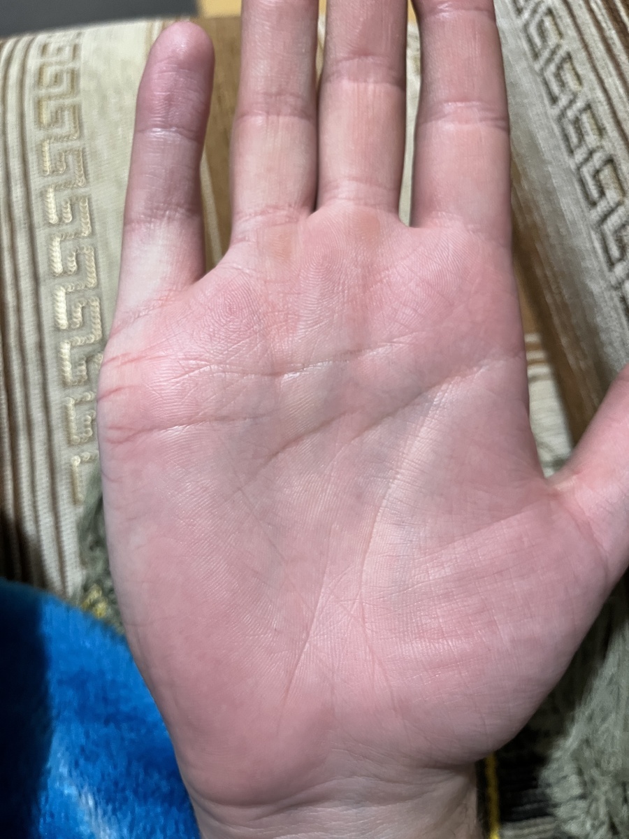 Фото руки с моего канала Дзен. 