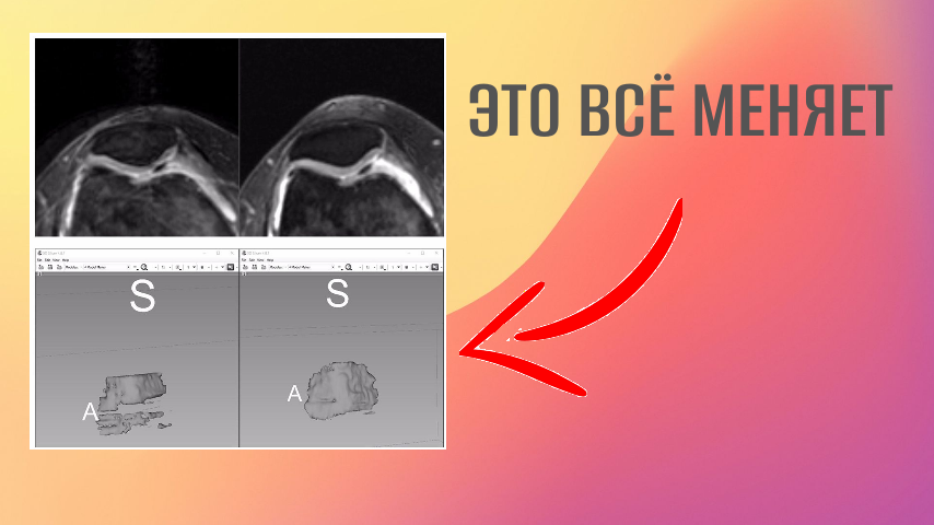 Восстановление/улучшение хряща по науке