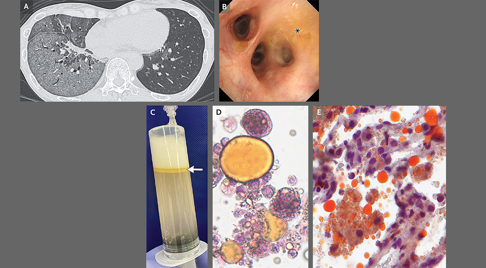   Taichi Kaneko, Ryota Otoshi / NEJM, 2025