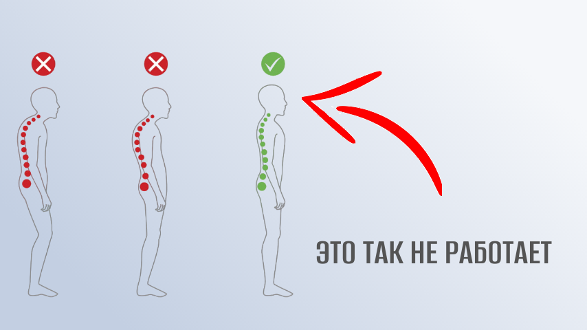 Красивая и нездоровая осанка.