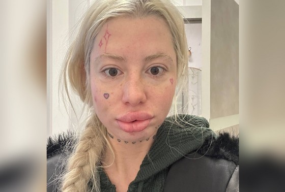    Анна Михеева (Хофманнита)