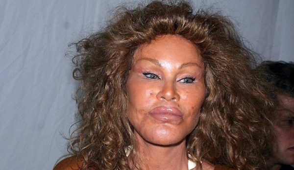    Джослин Вильденштейн. Фото: ТВЦ