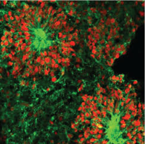 Органоиды мозга были здоровы и продолжали расти после месяца пребывания на Международной космической станции. (Фото: Джин Лоринг).