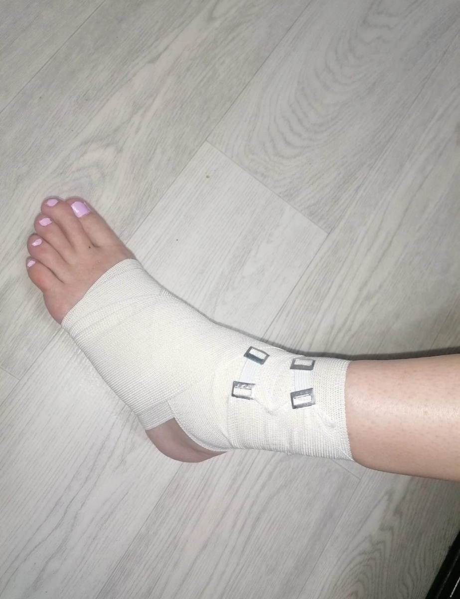 Левая нога автора.. июнь 2023 г