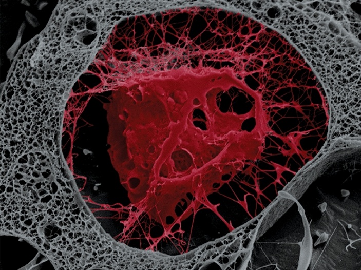 Остеобласт в костном матриксе