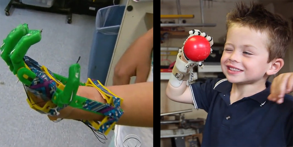 Леон родился без пальцев на левой руке, он живёт без протеза уже 12 лет. Врачи говорят, что причиной увечья послужило ограниченное кровообращение в этой конечности, когда малыш находился еще в чреве матери…

