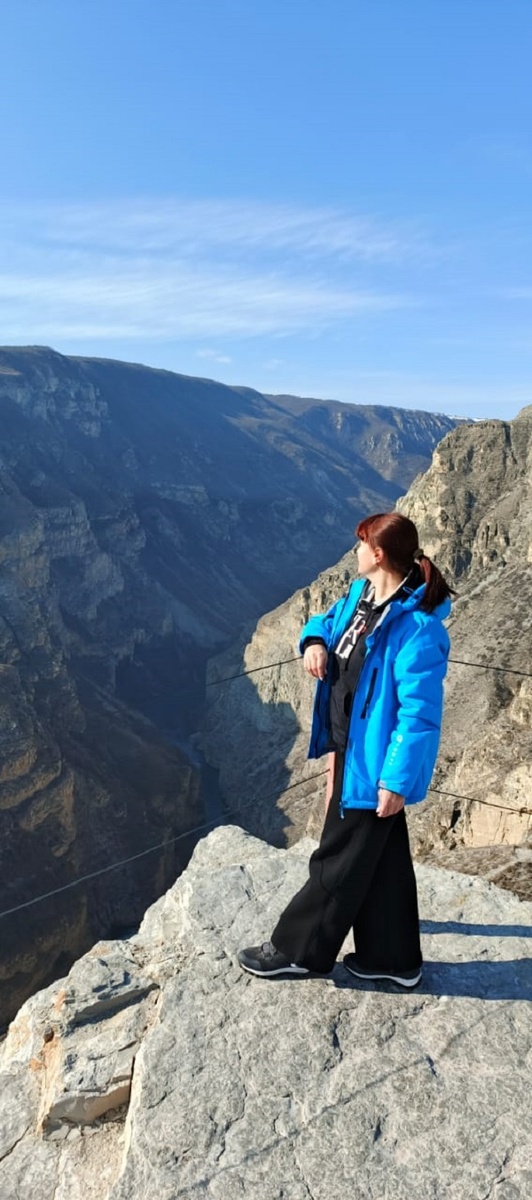 Это фотогалерея, фотографии можно листать