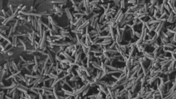 Бактерии из рода Anoxybacillus, вырабатывающие фермент амилазу (фото под микроскопом)
© Photo:provided by Hovik Panosyan