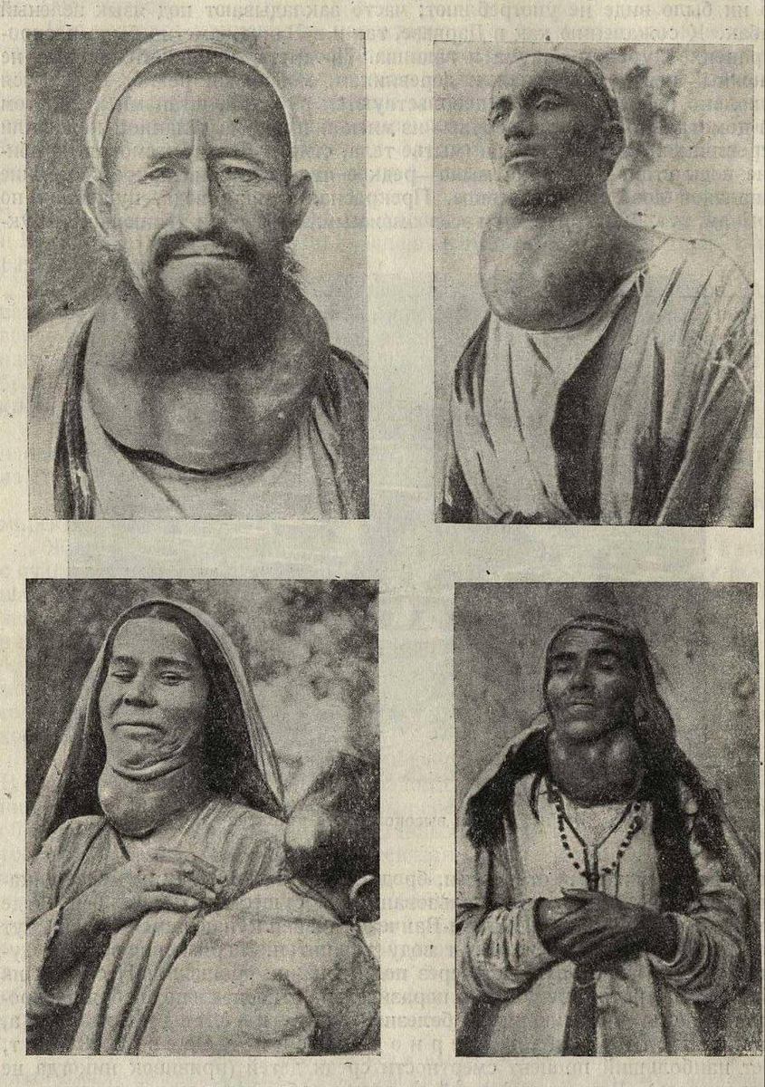 Типы зобатых памирцев Ванча