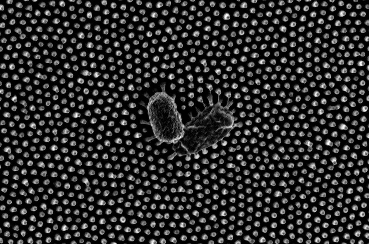 Две бактерии деформировались под наностолбиками, а одна (справа) в результате разорвалась. Фото: Yutao Chen; Beckman Institute/University of Illinois Urbana-Champaign.