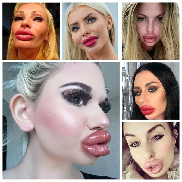 Уродство или красота?