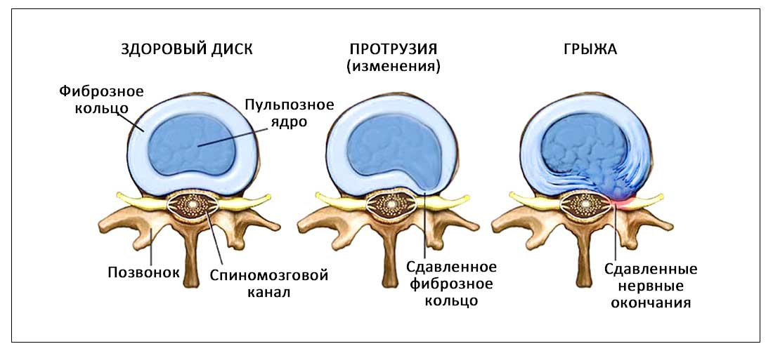 Изображение с сайта: nouvelleclinic.ru