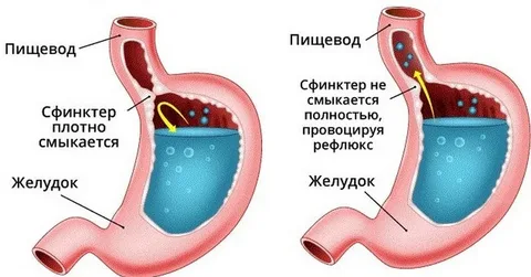 ГЭ