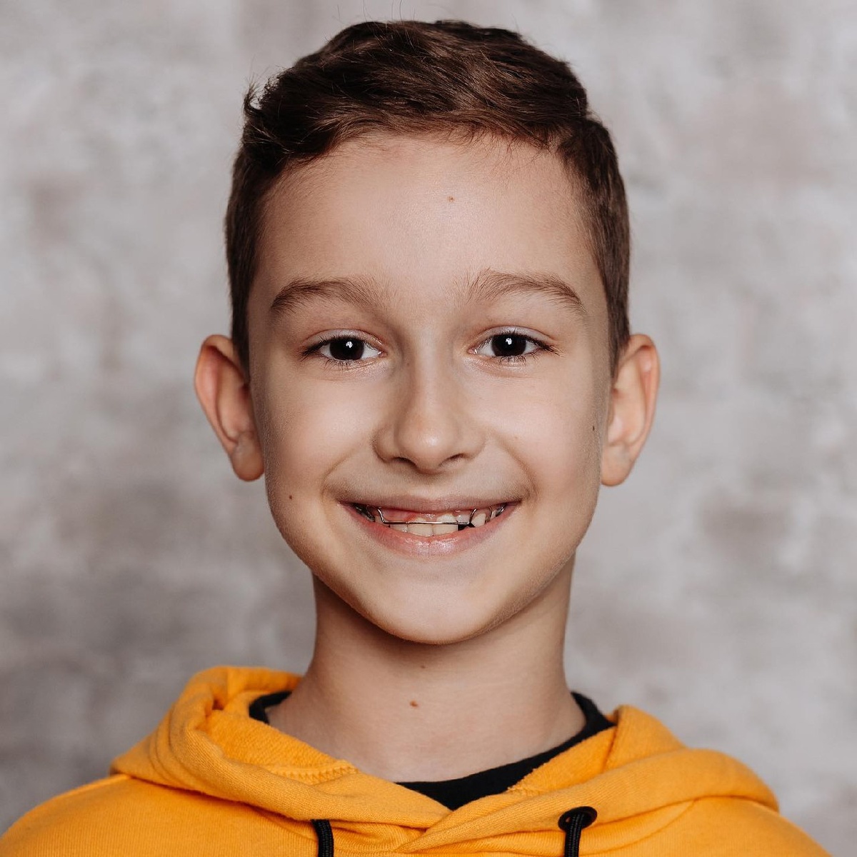 Юный пациент клиники ПРАЙМ, который проходит лечение ортодонтическими пластинами.