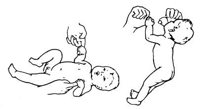 Рис.2.  Хватательный рефлекс и рефлекс Робинзона 