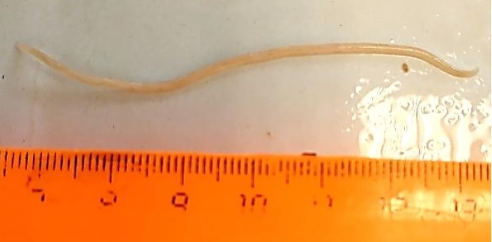 Нематода Ascaridia galli. (длина 72,00 мм)