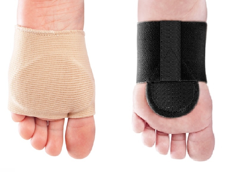 Стяжка стопы при плоскостопии