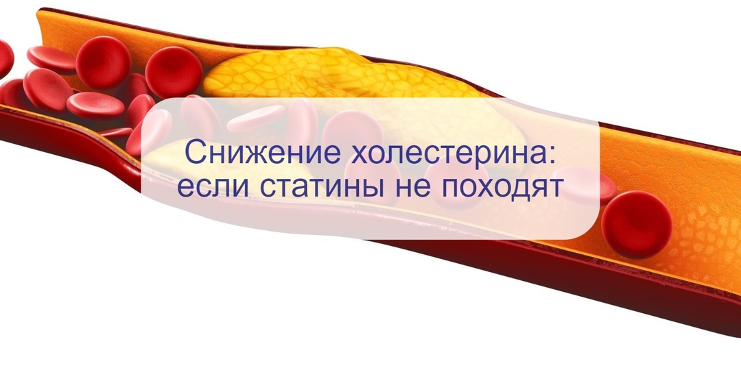 Если статины не подходят: варианты лекарств для снижения уровня холестерина нестатинового ряда