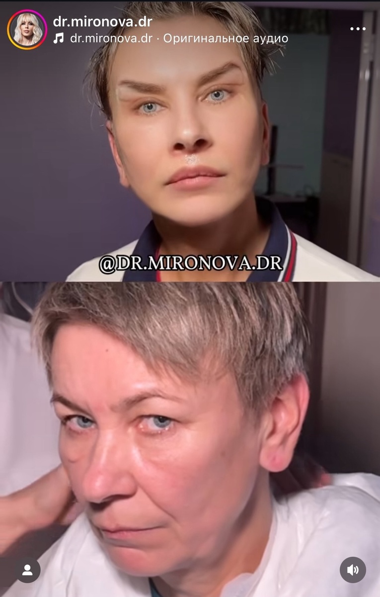 Преображение удалось! Надежда помолодела лет на 20! Похожа на Шамана или нет- не важно!!! Фото со страницы пластического хирурга